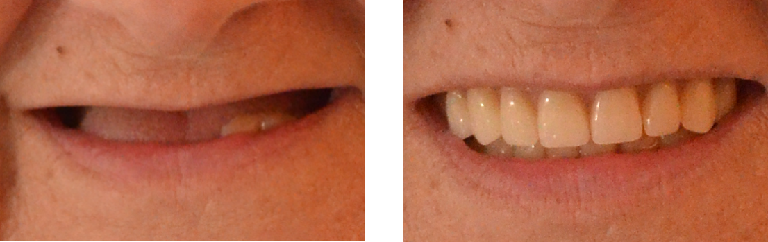 beforeafter2